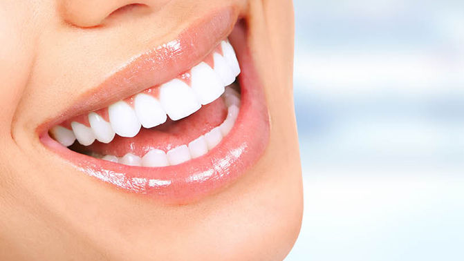 Bright teeth